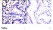 Synuclein Gamma antibody, ab55424, Abcam, Immunohistochemistry paraffin image 