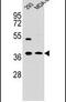 Annexin A2 antibody, PA5-14317, Invitrogen Antibodies, Western Blot image 