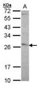 Glutathione S-Transferase Pi 1 antibody, TA308806, Origene, Western Blot image 