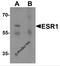Estrogen Receptor 1 antibody, 7437, ProSci, Western Blot image 