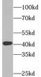 Synaptonemal Complex Central Element Protein 1 antibody, FNab08411, FineTest, Western Blot image 