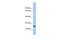 Sperm-Tail PG-Rich Repeat Containing 3 antibody, PA5-70192, Invitrogen Antibodies, Western Blot image 