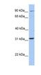 Extracellular Leucine Rich Repeat And Fibronectin Type III Domain Containing 2 antibody, NBP1-91363, Novus Biologicals, Western Blot image 