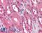 ATM Serine/Threonine Kinase antibody, LS-B1329, Lifespan Biosciences, Immunohistochemistry paraffin image 