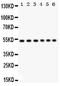 Unc-51 Like Kinase 3 antibody, PA5-80207, Invitrogen Antibodies, Western Blot image 