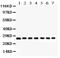 Galectin 3 antibody, PB9279, Boster Biological Technology, Western Blot image 