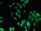 Fumarate Hydratase antibody, LS-C395741, Lifespan Biosciences, Immunofluorescence image 