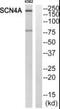 Sodium Voltage-Gated Channel Alpha Subunit 4 antibody, PA5-39462, Invitrogen Antibodies, Western Blot image 