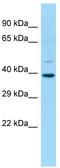Indoleamine 2,3-dioxygenase 2 antibody, TA337716, Origene, Western Blot image 