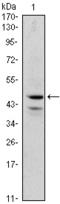 GATA Binding Protein 1 antibody, STJ98097, St John