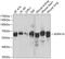 Adrenoceptor Alpha 1A antibody, GTX33002, GeneTex, Western Blot image 