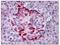 EPH Receptor A2 antibody, AP08276PU-N, Origene, Immunohistochemistry paraffin image 