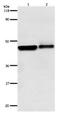 Adrenoceptor Beta 2 antibody, orb107456, Biorbyt, Western Blot image 