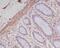 Actin Alpha 2, Smooth Muscle antibody, M01072-1, Boster Biological Technology, Immunohistochemistry paraffin image 