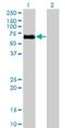 Bone Morphogenetic Protein Receptor Type 1A antibody, H00000657-M01, Novus Biologicals, Western Blot image 