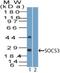 Suppressor Of Cytokine Signaling 3 antibody, NBP2-27210, Novus Biologicals, Western Blot image 