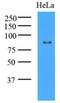 Lysine Acetyltransferase 2A antibody, NBP1-48593, Novus Biologicals, Western Blot image 