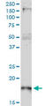 p21 antibody, LS-C196885, Lifespan Biosciences, Western Blot image 