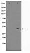 Zinc Finger And SCAN Domain Containing 25 antibody, TA347610, Origene, Western Blot image 