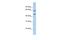 Adenosine Deaminase 2 antibody, A05566, Boster Biological Technology, Western Blot image 