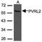 Nectin Cell Adhesion Molecule 2 antibody, NBP1-31486, Novus Biologicals, Western Blot image 