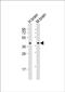 SH3 Domain Containing GRB2 Like 3, Endophilin A3 antibody, PA5-72264, Invitrogen Antibodies, Western Blot image 