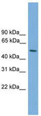 Serine/Threonine Kinase 38 Like antibody, TA333856, Origene, Western Blot image 