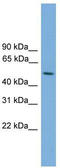 STK38L antibody, TA333856, Origene, Western Blot image 