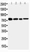 TNF Receptor Superfamily Member 1B antibody, PA1974, Boster Biological Technology, Western Blot image 