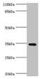 Transmembrane And Coiled-Coil Domains 5A antibody, CSB-PA843283LA01HU, Cusabio, Western Blot image 