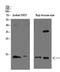 T Cell Leukemia/Lymphoma 1A antibody, STJ98671, St John