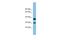 Receptor Transporter Protein 4 antibody, A11368, Boster Biological Technology, Western Blot image 