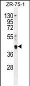 Pygopus Family PHD Finger 1 antibody, PA5-35112, Invitrogen Antibodies, Western Blot image 