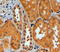 E3 ubiquitin-protein ligase TRIM11 antibody, LS-C55618, Lifespan Biosciences, Immunohistochemistry paraffin image 