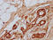 Tubulin Tyrosine Ligase Like 3 antibody, LS-C681637, Lifespan Biosciences, Immunohistochemistry paraffin image 