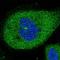 Chromosome 6 Open Reading Frame 62 antibody, NBP1-90533, Novus Biologicals, Immunofluorescence image 