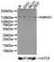 NPHS1 Adhesion Molecule, Nephrin antibody, CSB-PA015988LA01HU, Cusabio, Western Blot image 