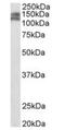 Par-3 Family Cell Polarity Regulator Beta antibody, orb125106, Biorbyt, Western Blot image 