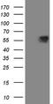 Mitochondrial Antiviral Signaling Protein antibody, M00169, Boster Biological Technology, Western Blot image 