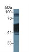 Keratin 1 antibody, LS-C294986, Lifespan Biosciences, Western Blot image 