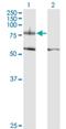 Integrin Subunit Beta 8 antibody, H00003696-M01, Novus Biologicals, Western Blot image 