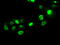 SATB Homeobox 1 antibody, LS-C784343, Lifespan Biosciences, Immunofluorescence image 