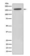 Histone Deacetylase 6 antibody, M00595, Boster Biological Technology, Western Blot image 