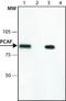 Lysine Acetyltransferase 2B antibody, GTX12188, GeneTex, Immunoprecipitation image 