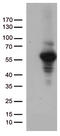 Matrix Metallopeptidase 11 antibody, CF812659, Origene, Western Blot image 