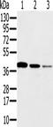 Synaptonemal Complex Protein 3 antibody, TA351636, Origene, Western Blot image 