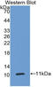 Carcinoembryonic Antigen Related Cell Adhesion Molecule 7 antibody, LS-C314298, Lifespan Biosciences, Western Blot image 