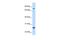 Glutathione S-Transferase Mu 2 antibody, PA5-42065, Invitrogen Antibodies, Western Blot image 