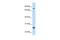 Glutathione S-transferase Mu 2 antibody, PA5-42065, Invitrogen Antibodies, Western Blot image 