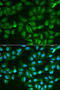 Galectin 3 antibody, LS-B14625, Lifespan Biosciences, Immunofluorescence image 